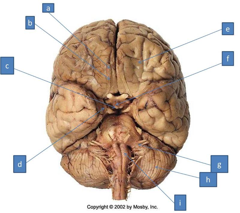 Neuro Lab Block I- Brain Stem Gross Anatomy Flashcards | Easy Notecards