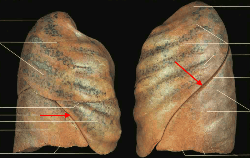Print gross lab practical 2 flashcards | Easy Notecards