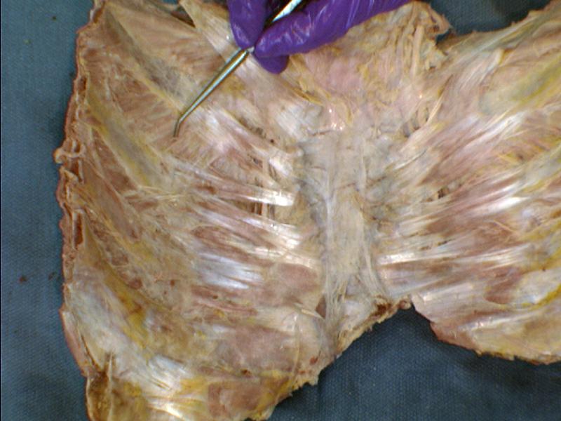 Print PA Anatomy Study List 1: Thoracic Wall & Thoracic Cavity