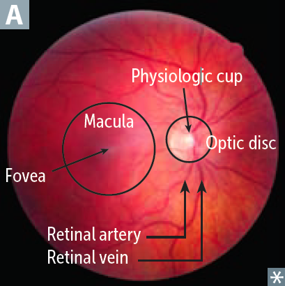 Print Neuro Eye Anatomy_Catarac flashcards | Easy Notecards