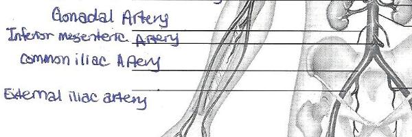 Print Exercise 32: Anatomy of Blood Vessels flashcards | Easy Notecards