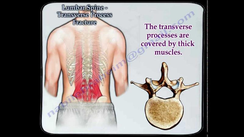 Print Mostly Vertebrae and ribs flashcards | Easy Notecards