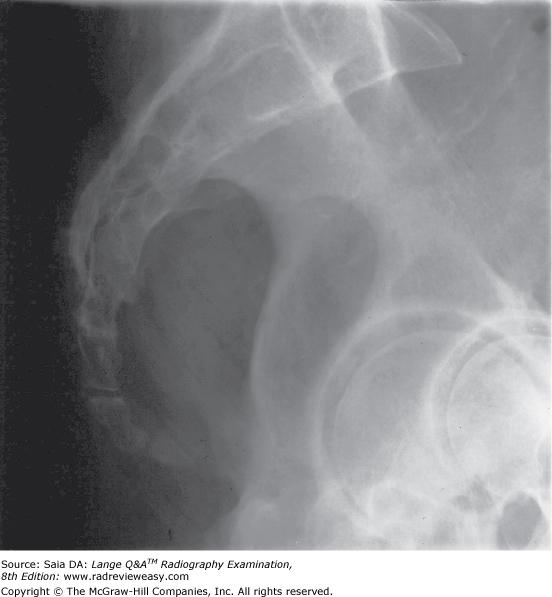 Anatomy, Positioning And Pathology Flashcards Easy Notecards