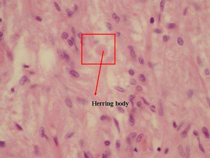 Path: Endocrine Flashcards | Easy Notecards