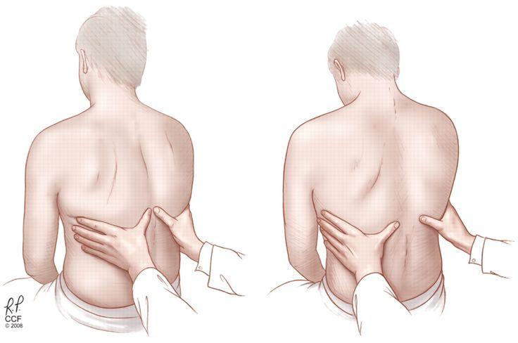 an illustration of a doctor measuring a patients back width with their hands.