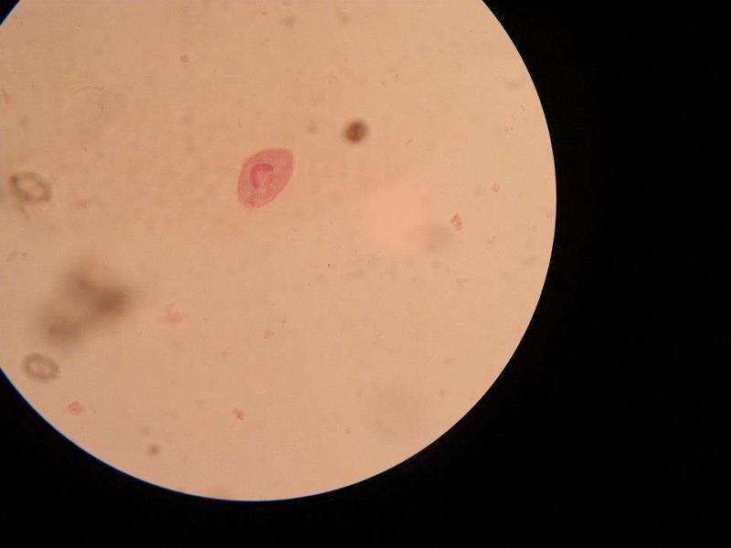 Print Protozoa - Lab Practical 2 flashcards | Easy Notecards