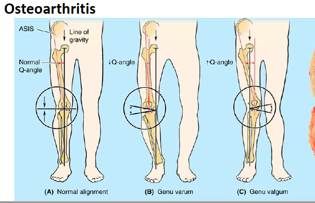 Print Lower Limb Slides & Learning objectives flashcards | Easy Notecards