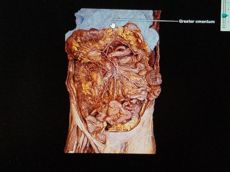 Print BIO 272_Digestive System Lab Exam Study Guide flashcards | Easy