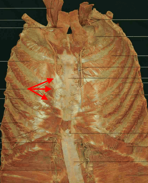 Print gross lab practical 2 flashcards | Easy Notecards