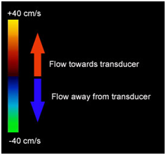 Doppler Ultrasound Color Chart