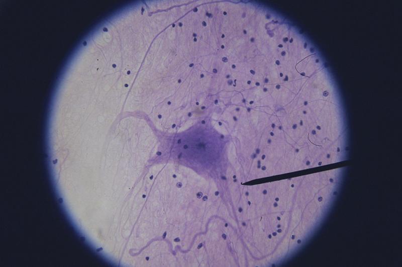 Activity 3: Nervous Tissue and Examining Nervous Tissue Under the