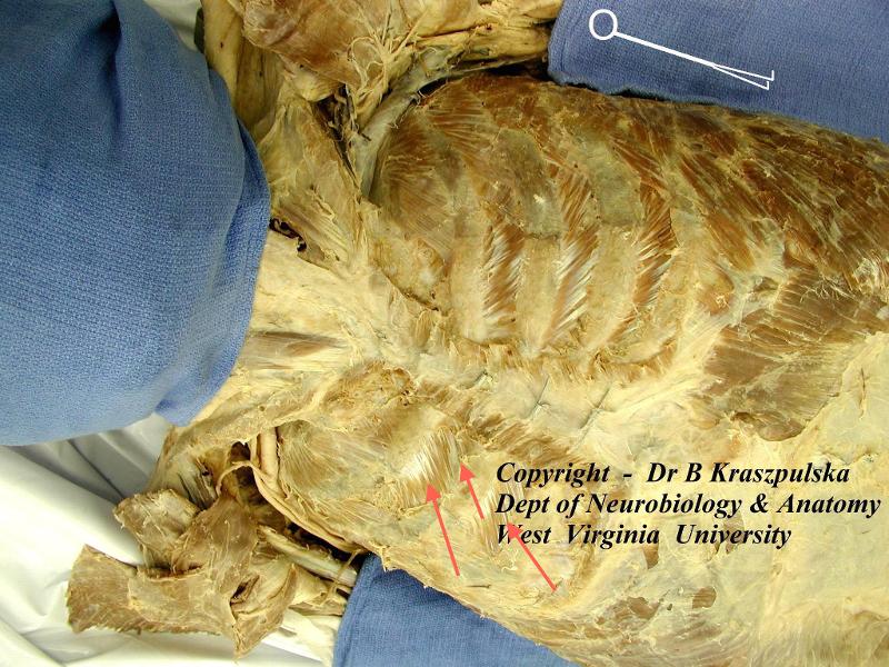 PA Anatomy Study List 1: Thoracic Wall & Thoracic Cavity Flashcards