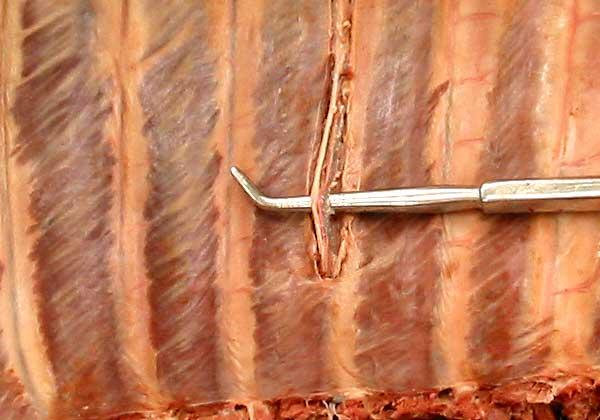 PA Anatomy Study List 1: Thoracic Wall & Thoracic Cavity Flashcards