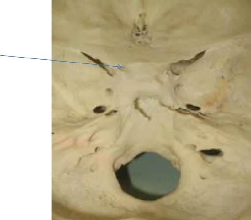 Print Neuro Block II- Cranial Nerves flashcards | Easy Notecards