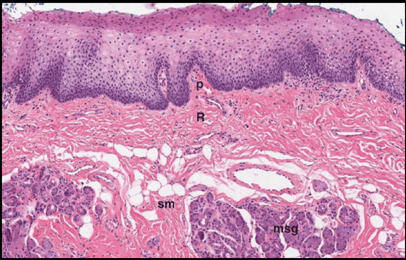 Print BS1-2-4-Oral Mucosa flashcards | Easy Notecards