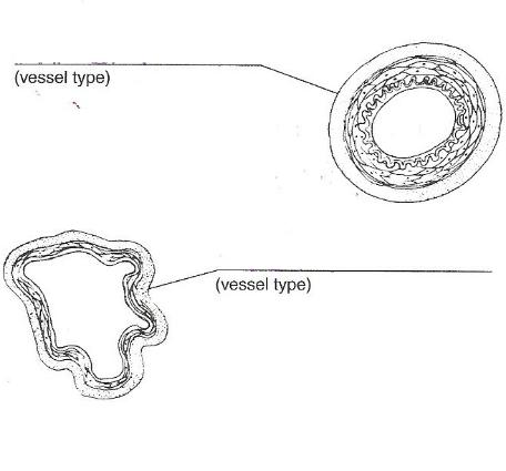 Fetal Circulation Chart Exercise 32