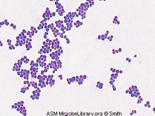 micrococcus luteus gram stain