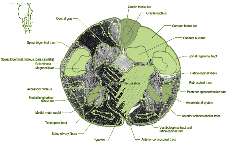 Pyramidal Decussation