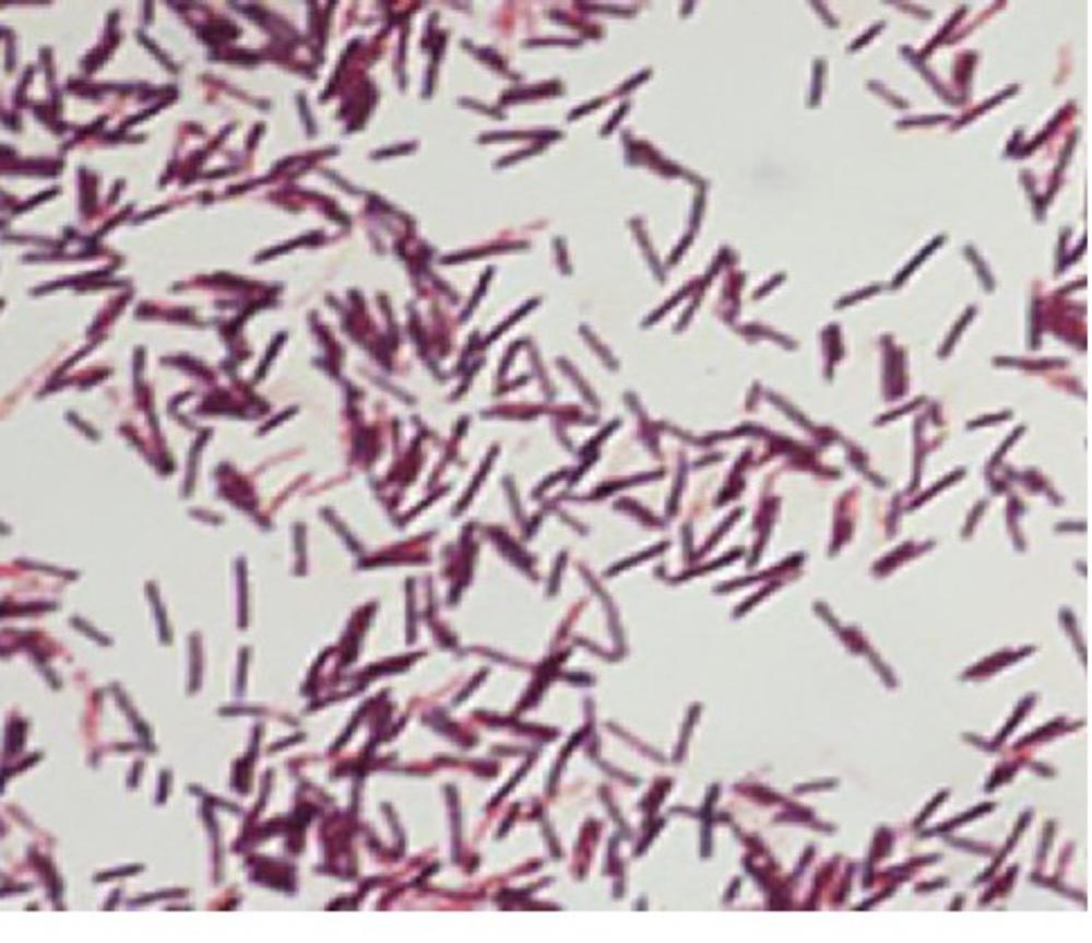 Ботулизм сальмонеллез. Bacillus Cereus Ожешко. Бациллы цереус Bacillus Cereus. Bacillus Cereus микроскоп. Бациллюс цереус микробиология.