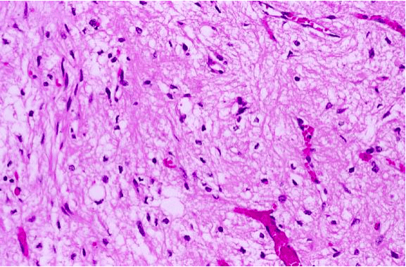 Нейрогипофиз гистология. Строение нейрогипофиза гистология. Гистология нейрогипофиза. Гипофиз гистология тельца херринга. Нейрогипофиз гистология.