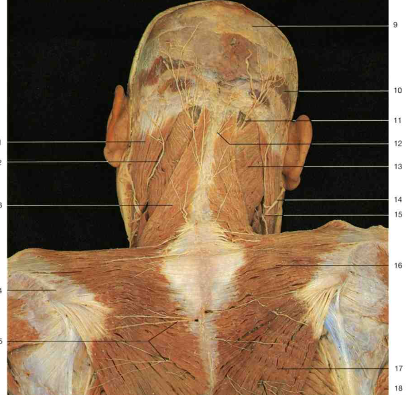 gross anatomy exam I - bones and OIIA Flashcards | Easy Notecards