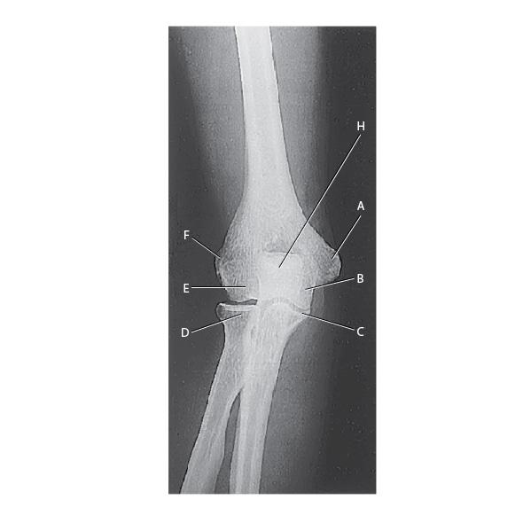 What Are The Parts Of The Elbow Called