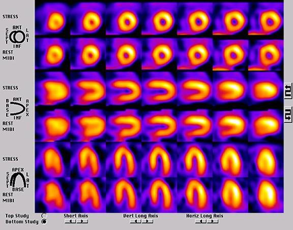 Print Medicine: Cardiac Radiology flashcards | Easy Notecards