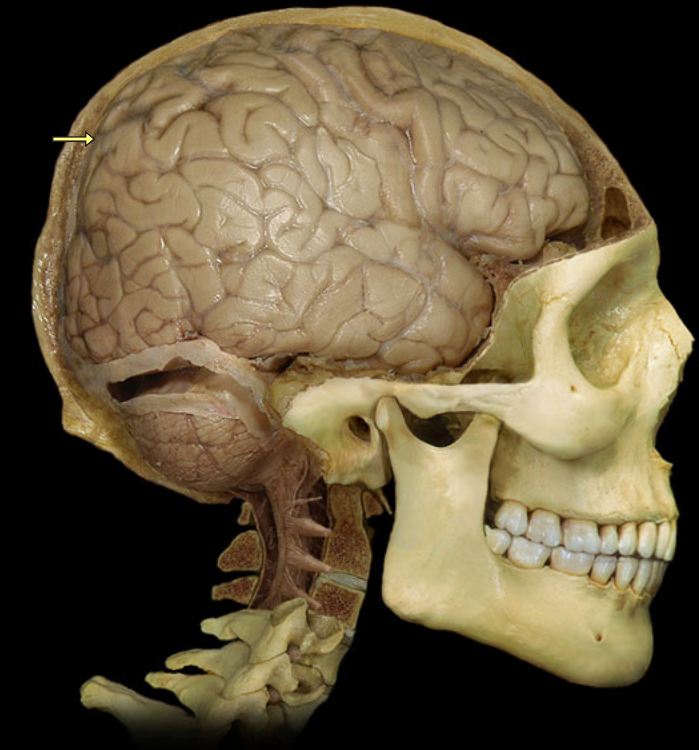 Мозг в черепной коробке. Corpus pineale анатомия. Черепная коробка человека.