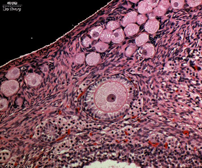 Print Reproductive Histology flashcards | Easy Notecards