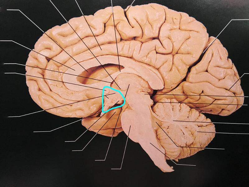 Складчатая поверхность головного мозга. Мозолистое тело и гипоталамус. Мозолистое тело анатомия. Эпиталамическая спайка мозга.